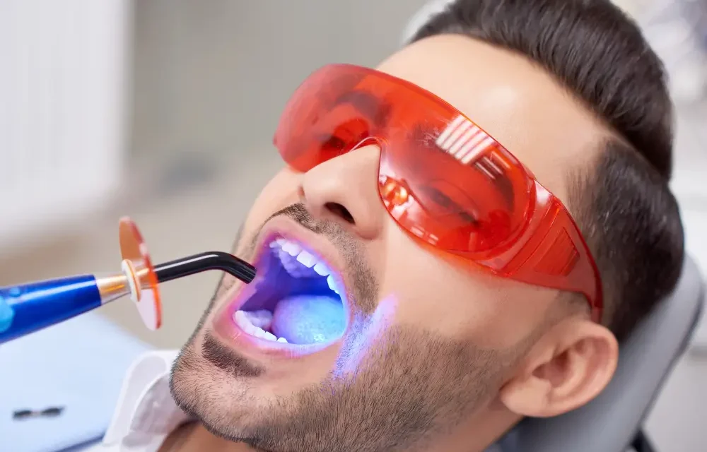 Professional Teeth Whitening vs Home Remedies Which Works Best?