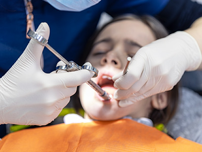 https://glosmileclinic.com/wp-content/uploads/2025/10/root-canal-treatment-1.jpg