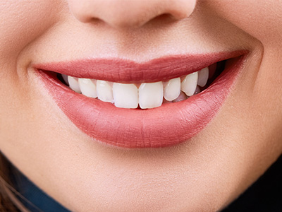 https://glosmileclinic.com/wp-content/uploads/2025/10/teeth-whitening.jpg